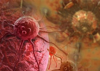 Oren Zarif – Treatments For Colorectal Cancer