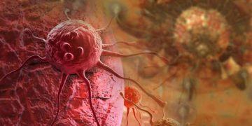 Oren Zarif – Treatments For Colorectal Cancer