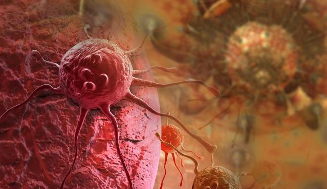 Oren Zarif – Treatments For Colorectal Cancer