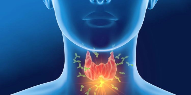 Oren Zarif – Treatments For Thyroid Cancer