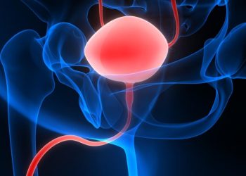 Oren Zarif – Treatments For Prostate Cancer