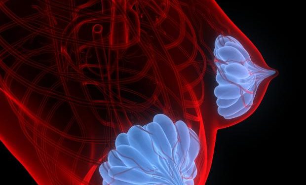 Oren Zarif – Treatments For Breast Cancer