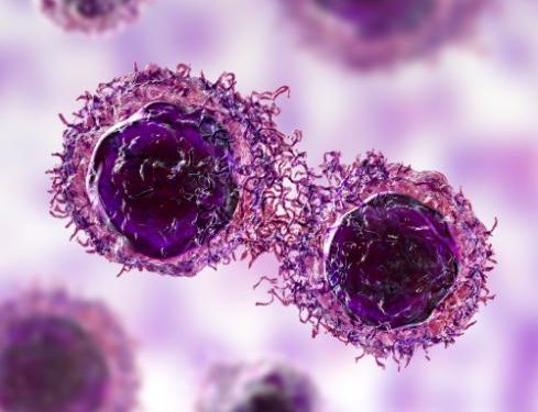 Oren Zarif – Treatments For Metastatic Cancer