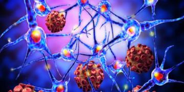 Oren Zarif – Treatments For Adrenocortical Carcinoma