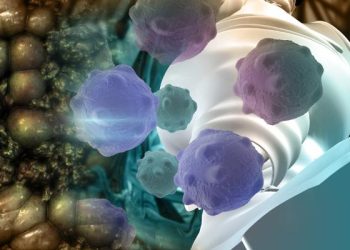 Oren Zarif – Treatments For Adrenocortical Carcinoma