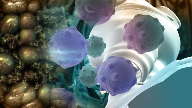 Oren Zarif – Treatments For Adrenocortical Carcinoma